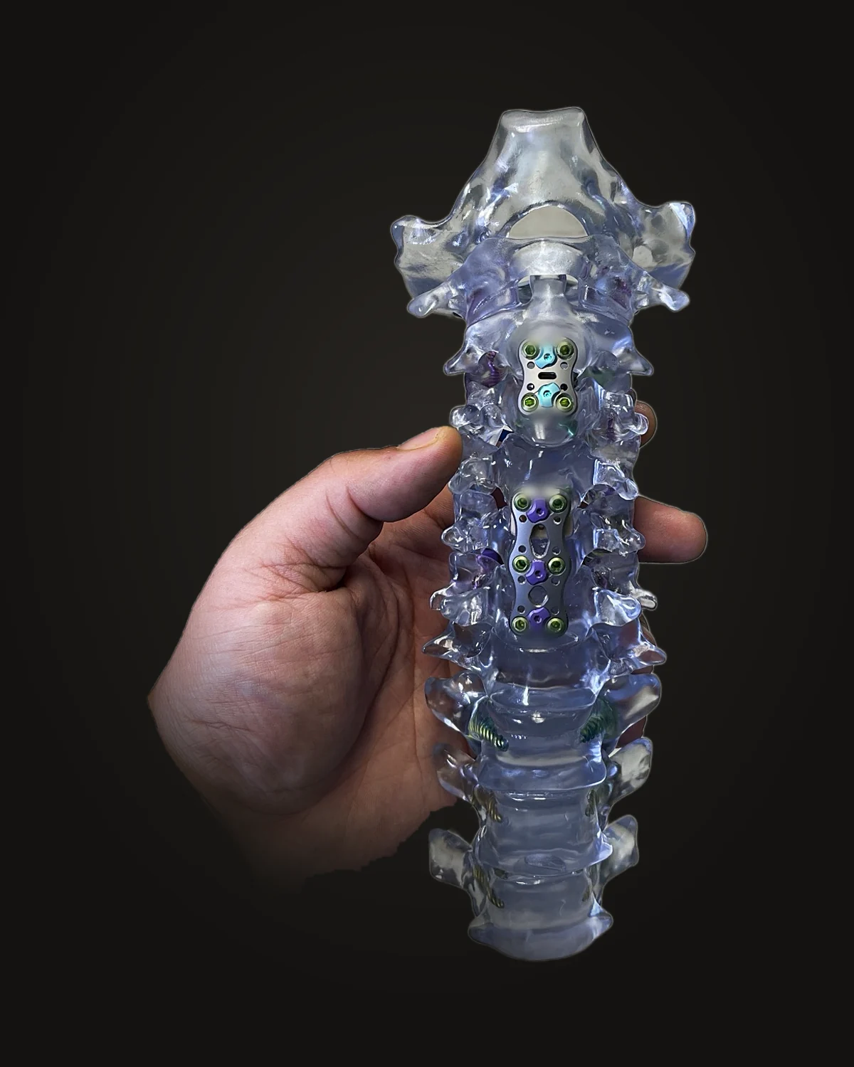 Cervical spine model with two anterior plates