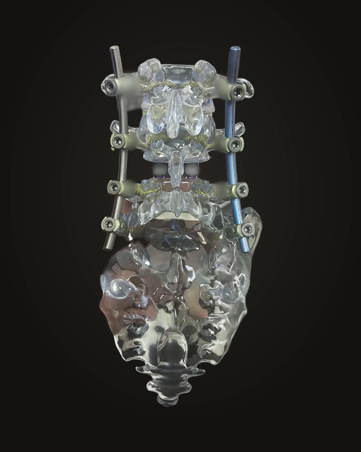 Lumbar and sacrum model with pedicle screws and two rods